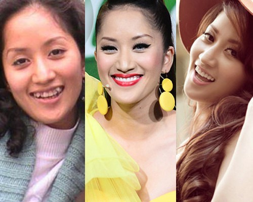 Chỉ cần làm răng, loạt sao Việt đã lên đời nhan sắc thế này!
