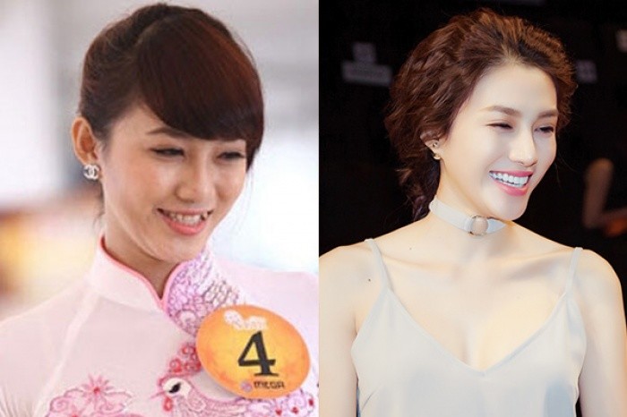 Chỉ cần làm răng, loạt sao Việt đã lên đời nhan sắc thế này!