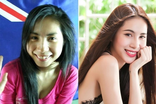 Chỉ cần làm răng, loạt sao Việt đã lên đời nhan sắc thế này!