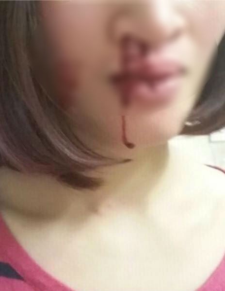 Vừa sảy thai 1 tuần, người vợ này chẳng những không được an ủi mà còn bị chồng tát bật máu trước mặt con nhỏ