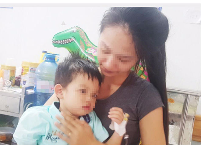 Viên đạn súng hơi nằm sâu trong phế quản bé trai 4 tuổi cả tháng nhưng người nhà không hay