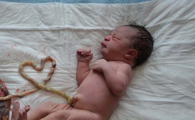 Bộ Y tế vào cuộc vụ mẹ con sản phụ tử vong vì sinh thuận tự nhiên gây rúng động dư luận