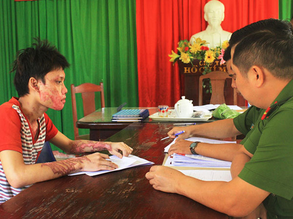 Bắt tạm giam kẻ tạt axít vào người tình rồi tự tử