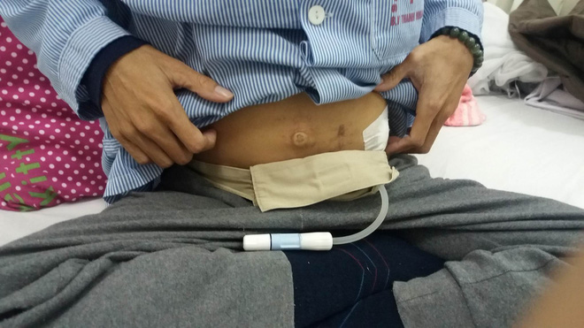 Chưa kịp đón con gái chào đời, bố nhập viện vì suy thận, một mình mẹ ngược xuôi suốt 7 năm trời lo lắng cho cả gia đình