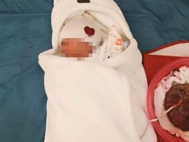 Những biến chứng cực kỳ nguy hiểm khi sinh con thuận tự nhiên