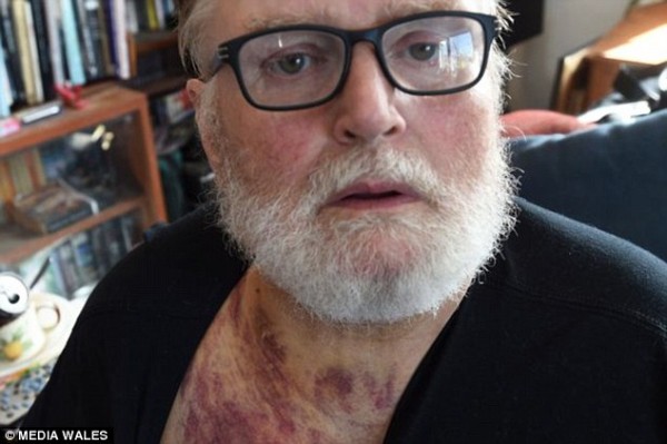 Ô tô cắm đầu trên cửa sổ do tài xế đạp nhầm chân ga khi phanh