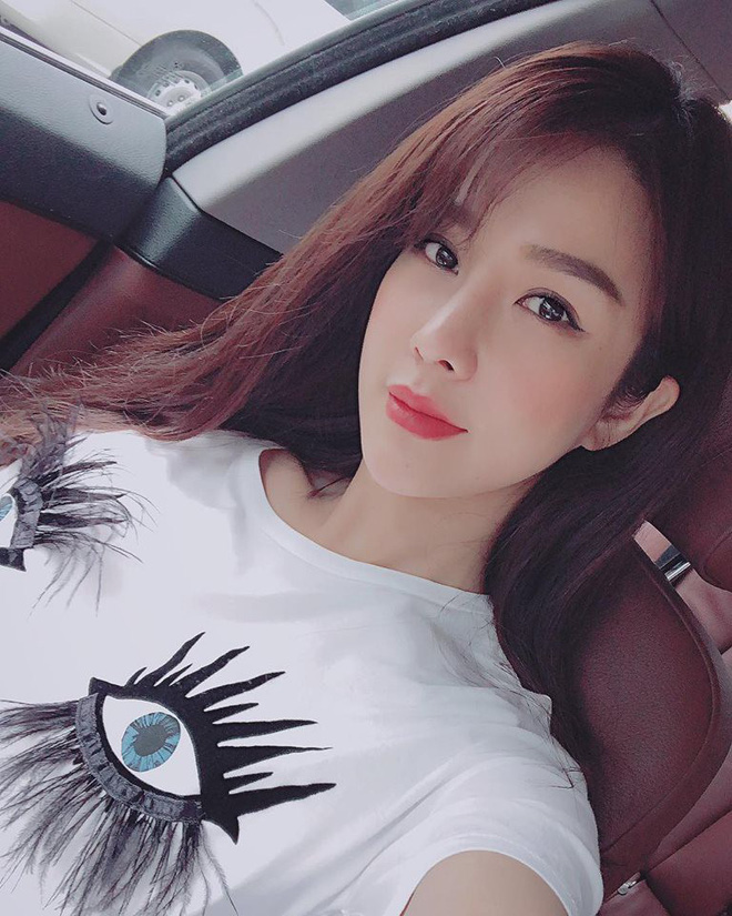 Gương mặt căng cứng phù nề ngày nào của Diệp Lâm Anh nay đã hài hòa và vào nét hơn hẳn