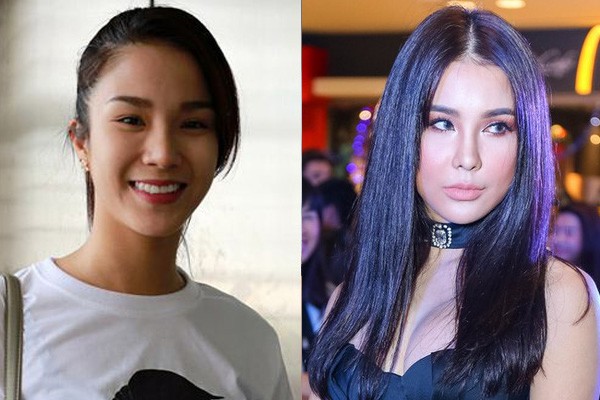 Gương mặt căng cứng phù nề ngày nào của Diệp Lâm Anh nay đã hài hòa và vào nét hơn hẳn