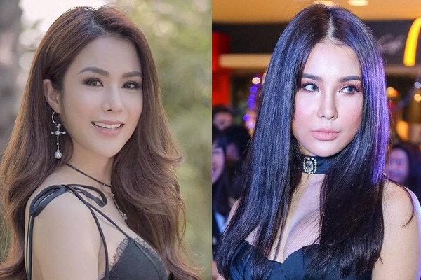 Gương mặt căng cứng phù nề ngày nào của Diệp Lâm Anh nay đã hài hòa và vào nét hơn hẳn