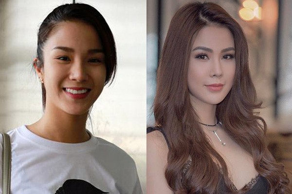 Gương mặt căng cứng phù nề ngày nào của Diệp Lâm Anh nay đã hài hòa và vào nét hơn hẳn