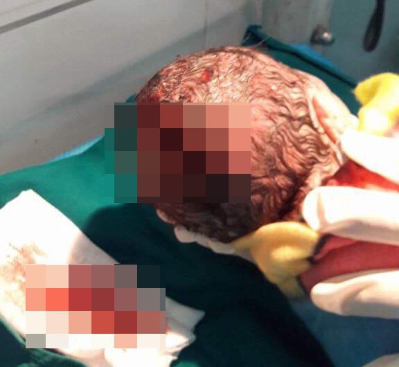 Đau lòng trước những hậu quả trẻ sơ sinh gánh phải khi người lớn cuồng phương pháp thuận tự nhiên