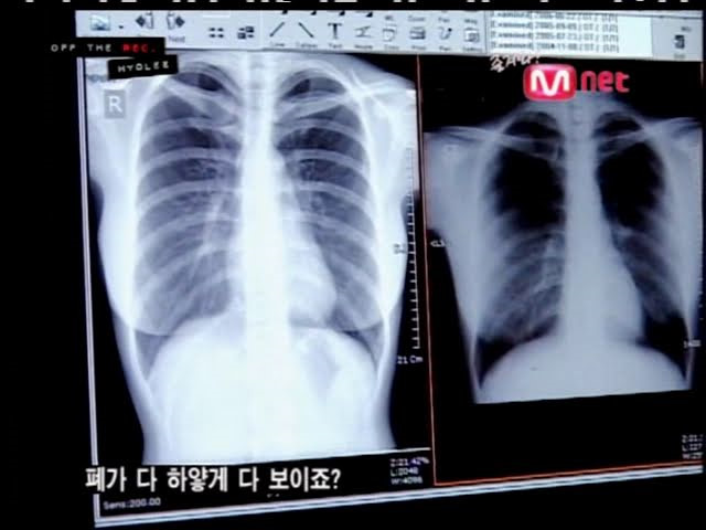 3 sao nữ Hàn công bố bằng chứng không phẫu thuật thẩm mỹ