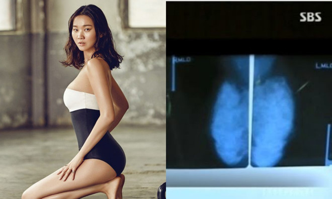 3 sao nữ Hàn công bố bằng chứng không phẫu thuật thẩm mỹ