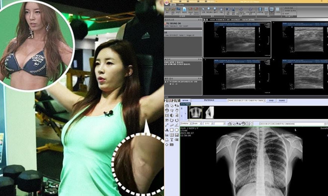 3 sao nữ Hàn công bố bằng chứng không phẫu thuật thẩm mỹ