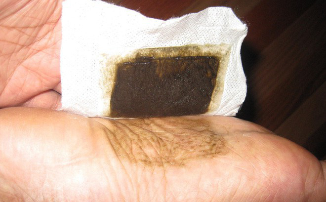 Sự thật về những miếng dán bàn chân giúp hút hết chất độc trong cơ thể