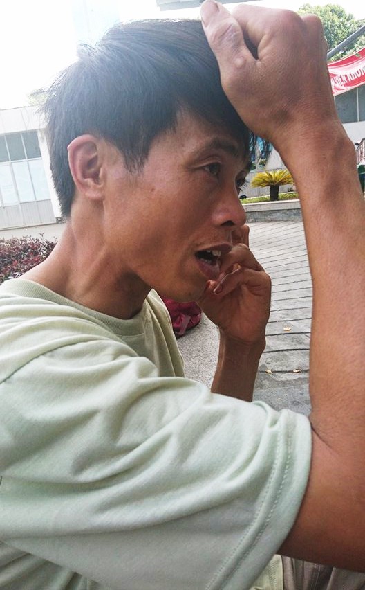 Thương tâm cha lóc da cứu con trai 3 tuổi bỏng toàn bộ cơ thể vì cháy nhà