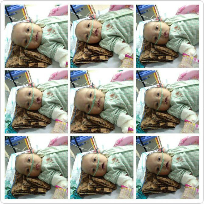 Lời cảnh tỉnh từ vụ việc bé trai 1 tháng tuổi tử vong do hít phải khói thuốc lá dẫn đến viêm phổi nặng