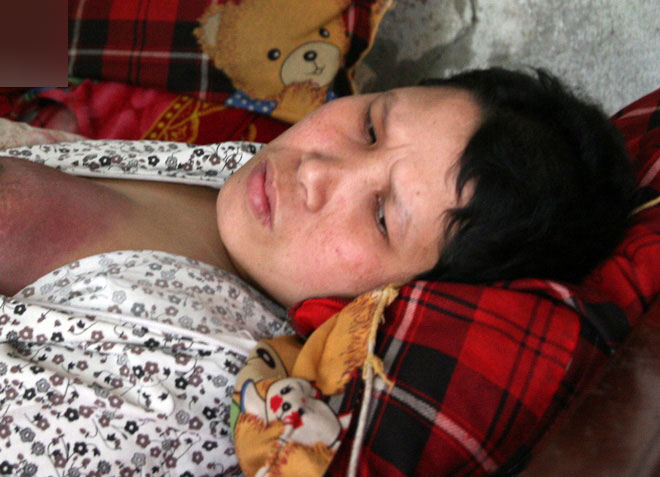 Nghẹn lòng cảnh đứa trẻ khát sữa nhìn chằm chằm ngực sưng tấy của mẹ vì bị ung thư vú trong gia đình có tới 4 người mù