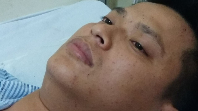 Trung úy điều khiển chiếc xe cứu hỏa gặp nạn: Em quá choáng và ngất ngay sau đó