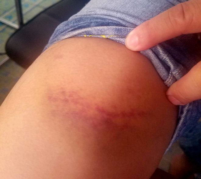 Tranh chấp làm ăn, người nước ngoài bị đánh ngất xỉu