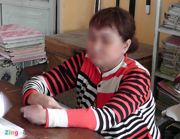 Xử phạt người phụ nữ hoang báo bị cướp 3,3 lượng vàng