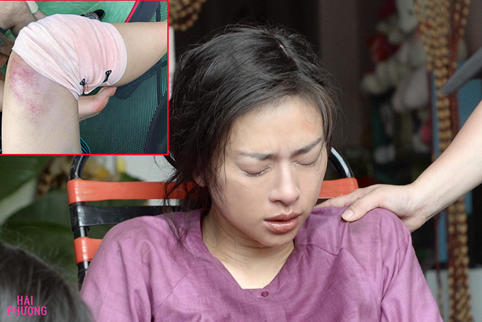 Ngô Thanh Vân phải nghỉ đóng phim một tháng vì tai nạn nghề nghiệp