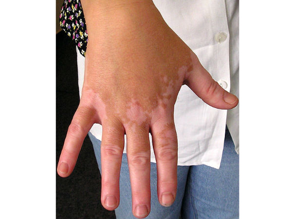 Điều gì xảy ra nếu bạn uống sữa khi ăn thịt gà