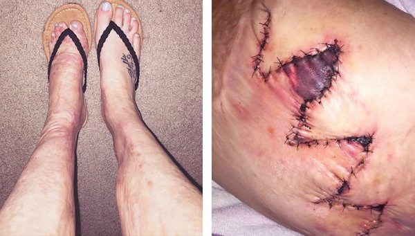 Điều đáng sợ phía sau những đám cháy