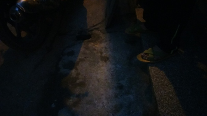 Hà Nội: Nữ giáo viên bị chồng cũ tạt axit ngay trước mặt bố đẻ và con gái 8 tuổi