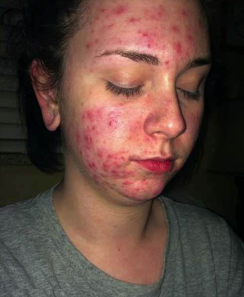 Những lưu ý khi sử dụng Vaseline để phát huy 10+ công dụng làm đẹp