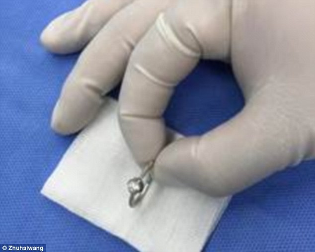 Vô tư đưa nhẫn đính hôn cho con gái 2 tuổi chơi, bà mẹ suýt lấy mạng con trong chốc lát