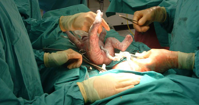 Không phải hôn nhân, phòng sinh mới là nấm mồ của tình yêu - câu chuyện được nhiều chị em đồng cảm, xót xa nhất ngày hôm nay