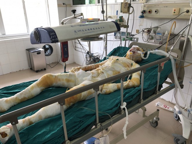 Hung thủ phóng hỏa thiêu sống 2 cô gái ở Vĩnh Phúc đối mặt hình phạt nào?