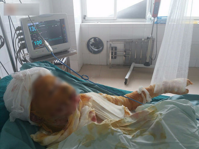 Vụ 2 cô gái bị thiêu sống ở Vĩnh Phúc: Nằm trên giường bệnh, người mẹ đau đớn nhìn con qua màn hình điện thoại cho vơi nỗi nhớ