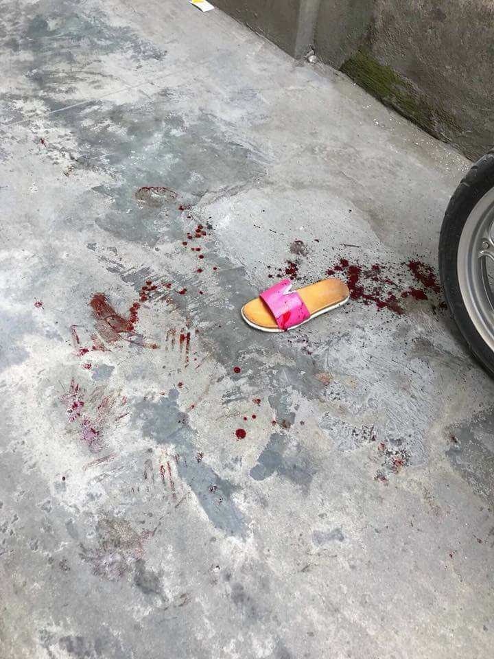 Côn đồ đất Cảng vác súng xông vào ngõ bắn người phụ nữ