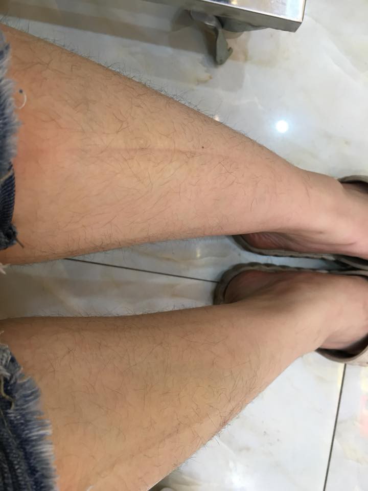 Chùm ảnh: Còn gì khổ hơn những cô nàng phận là con gái nhưng lông mọc còn rậm hơn con trai Chùm ảnh: Còn gì khổ hơn những cô nàng phận là con gái nhưng lông mọc còn rậm hơn con trai