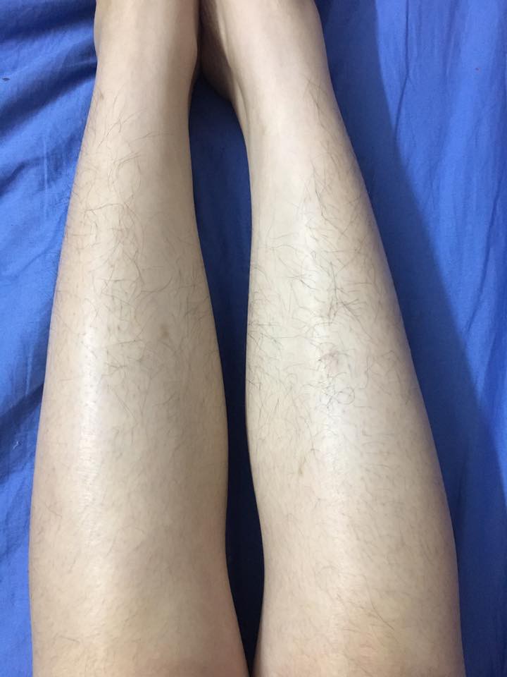Chùm ảnh: Còn gì khổ hơn những cô nàng phận là con gái nhưng lông mọc còn rậm hơn con trai Chùm ảnh: Còn gì khổ hơn những cô nàng phận là con gái nhưng lông mọc còn rậm hơn con trai