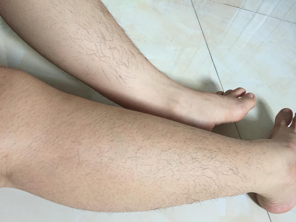 Chùm ảnh: Còn gì khổ hơn những cô nàng phận là con gái nhưng lông mọc còn rậm hơn con trai Chùm ảnh: Còn gì khổ hơn những cô nàng phận là con gái nhưng lông mọc còn rậm hơn con trai