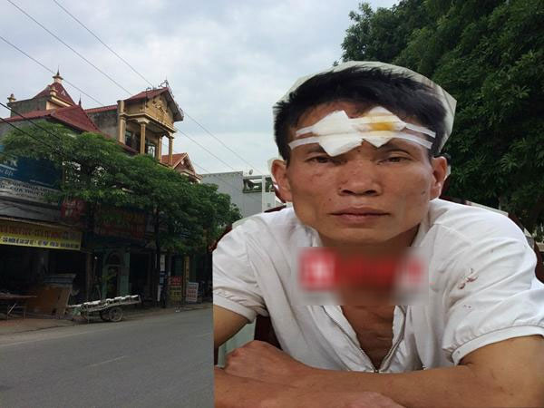 Công an tiết lộ nguyên nhân khiến chú chém cả họ trước giờ cháu đón dâu