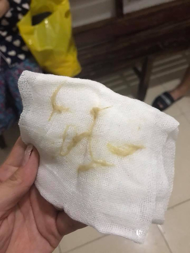 Cảnh báo từ bác sĩ: Cha mẹ cần cẩn thận với thủ phạm có thể khiến cho trẻ tử vong này