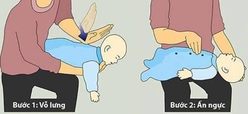 Cảnh báo từ bác sĩ: Cha mẹ cần cẩn thận với thủ phạm có thể khiến cho trẻ tử vong này