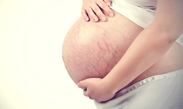 Ngỡ ngàng trước thái độ của người chồng khi nữ thư ký gửi ảnh bụng rạn chằng chịt của vợ