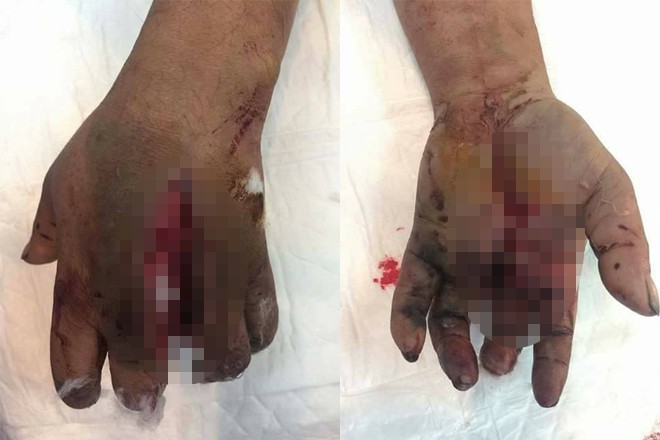 Cảnh báo: Sạc điện thoại hay sạc dự phòng ẩn chứa hiểm họa cháy nổ khôn lường, bạn nhất định phải biết để đảm bảo an toàn