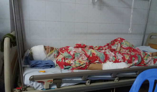 Người vợ bị chồng cũ tạt axit ở Hà Nội: Con không muốn anh ấy đi tù, con tha thứ