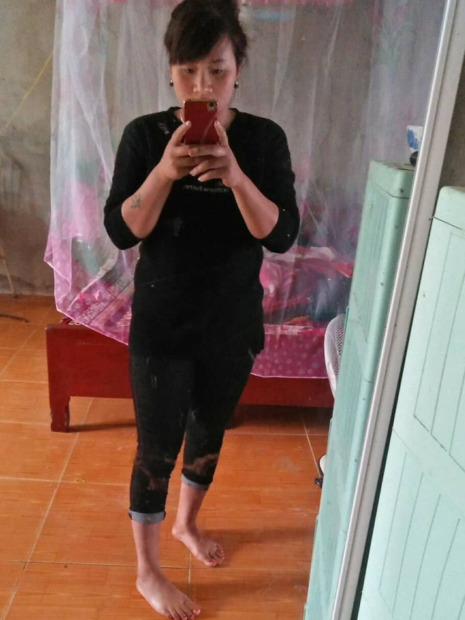 Hình ảnh mẹ trẻ 4 năm mổ 3 đứa con, tăng cân vùn vụt đến mất hết cả dáng khiến người xót kẻ chê