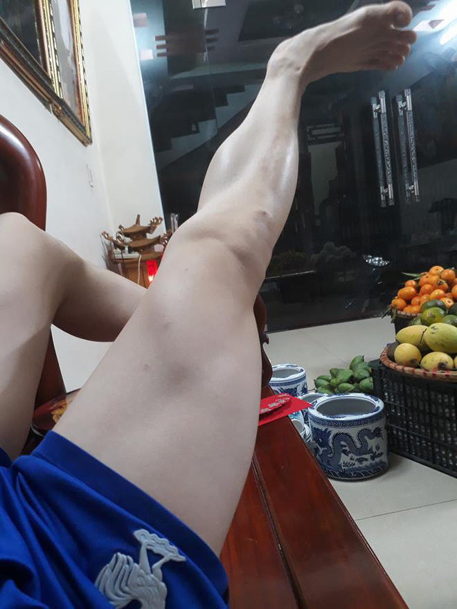 Có một nỗi khổ mang tên con trai mà chân tay không một cọng lông, láng mịn hơn cả con gái