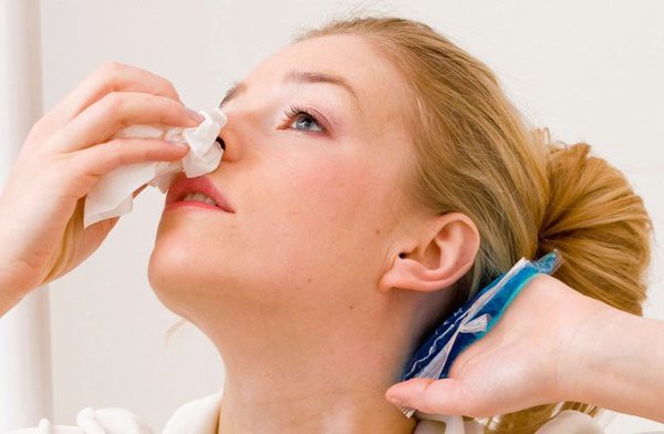 Để chảy máu cam chấm dứt không phải ngửa đầu ra sau, đây mới là cách sơ cứu đúng! Để chảy máu cam chấm dứt không phải ngửa đầu ra sau, đây mới là cách sơ cứu đúng!