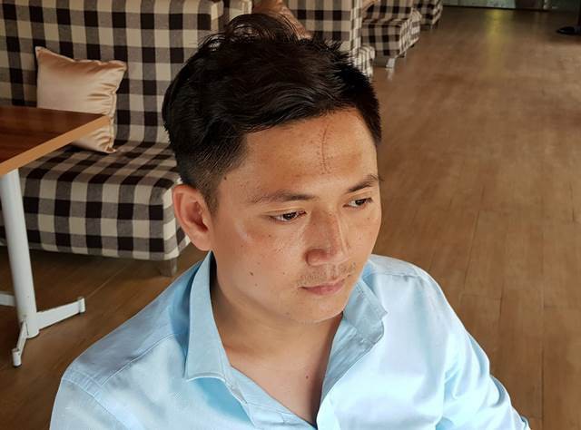 Hà Nam: Trên đường đưa con đi khám bệnh, ông bố bị 2 thanh niên hành hung