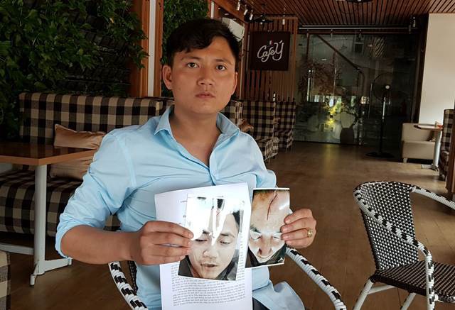 Hà Nam: Trên đường đưa con đi khám bệnh, ông bố bị 2 thanh niên hành hung