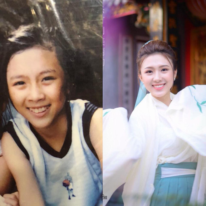 9X trở nên xinh đẹp sau 4 năm niềng răng